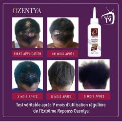 EXTREME POUSSE CHEVEUX OZENTYA 125 ML