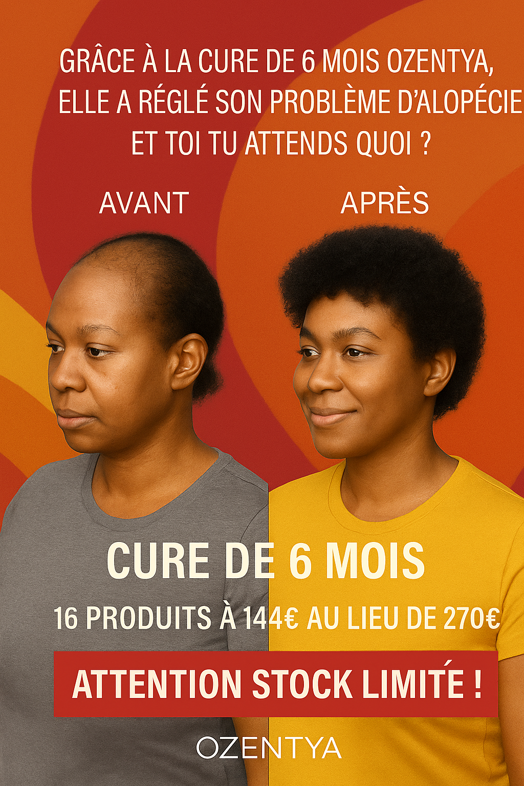 Cure de 6 Mois à -46,6% : Boostez Votre Pousse à Prix Mini !