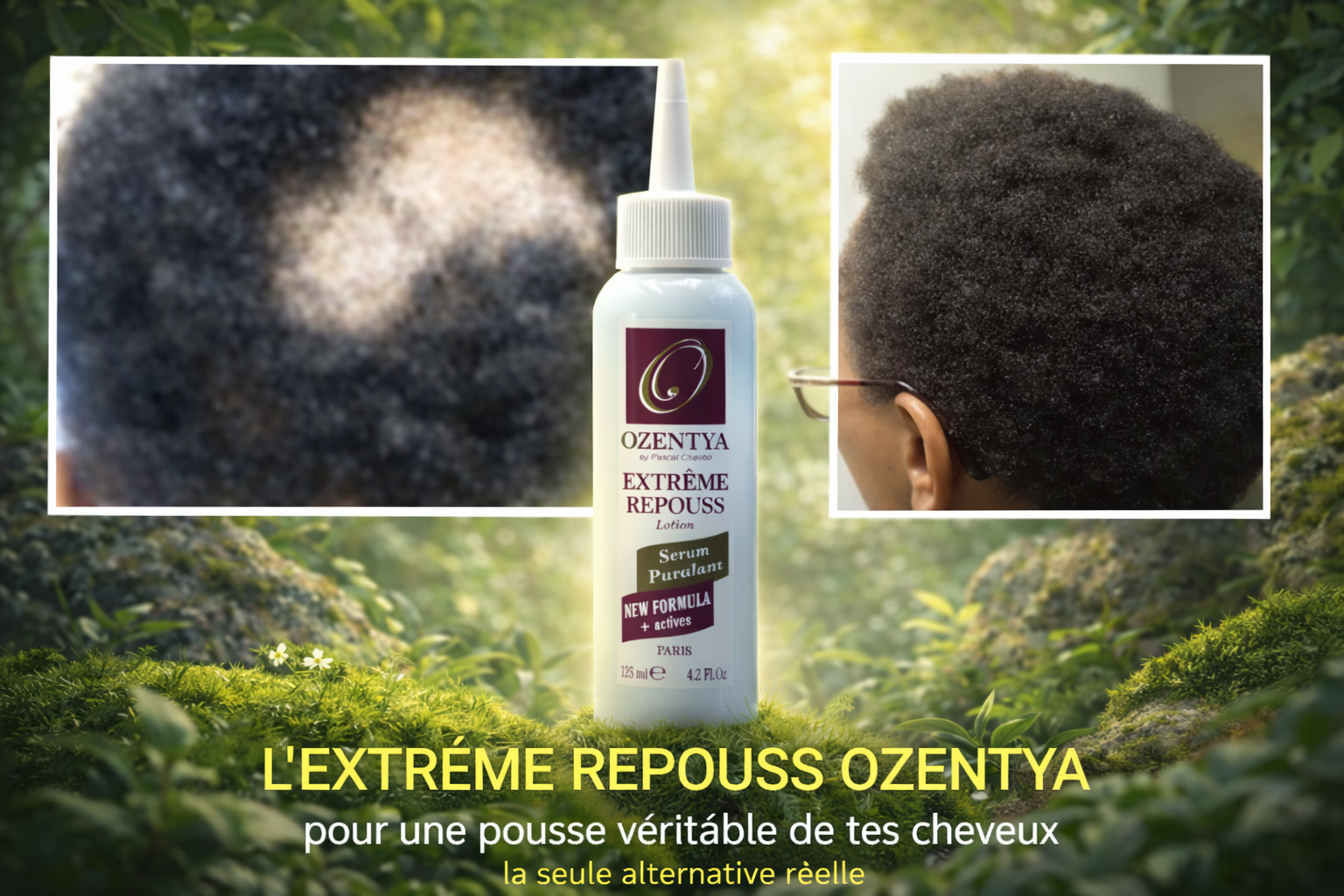 Extr�me Repouss � La Puissance Naturelle pour R�activer la Pousse